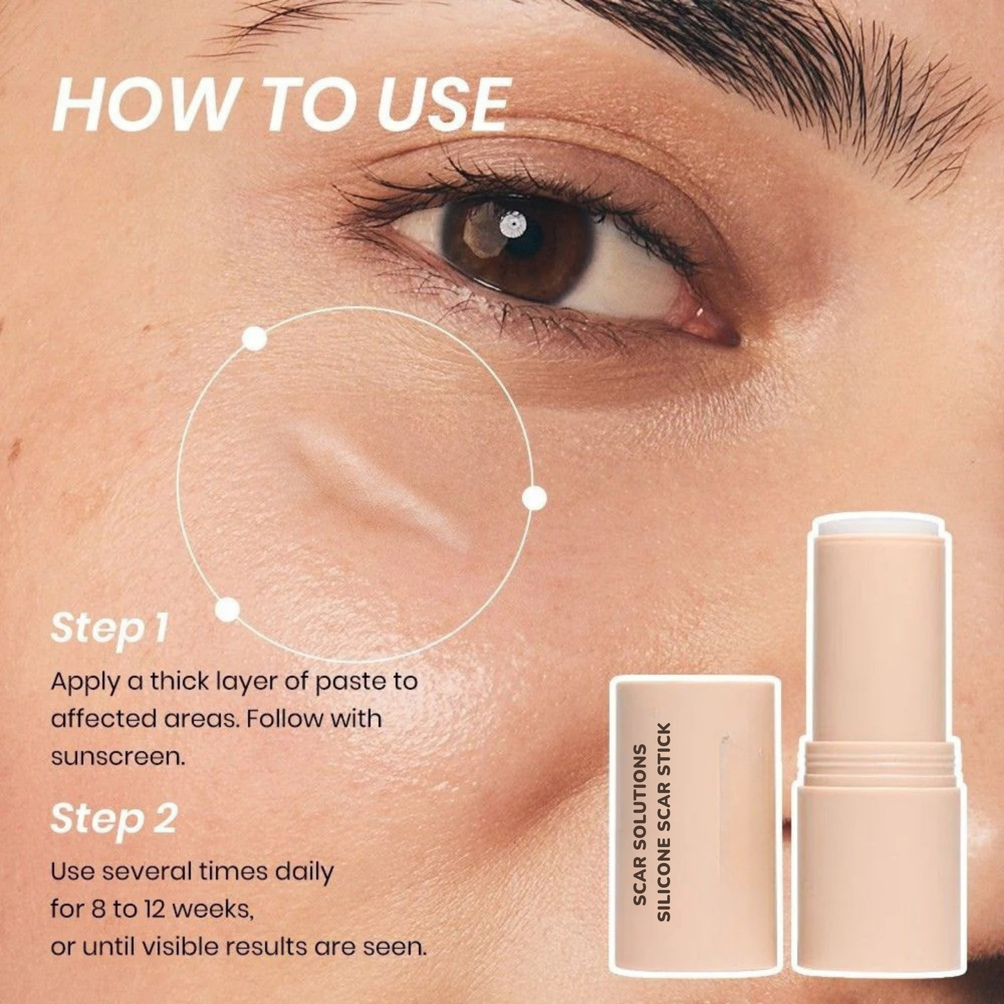 Silicone Scar stick