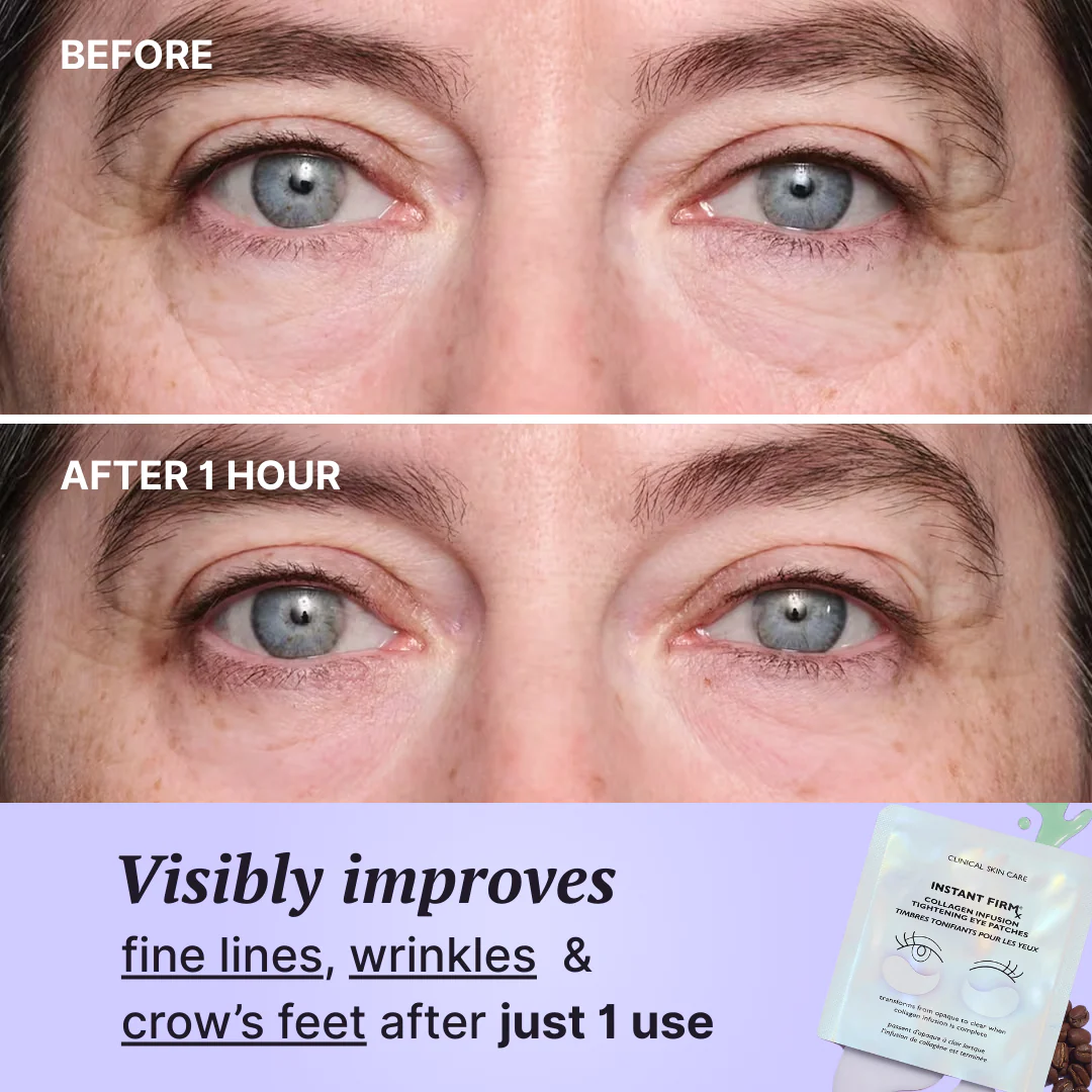 Instant Tightening Collagen Infusion Eye Patches