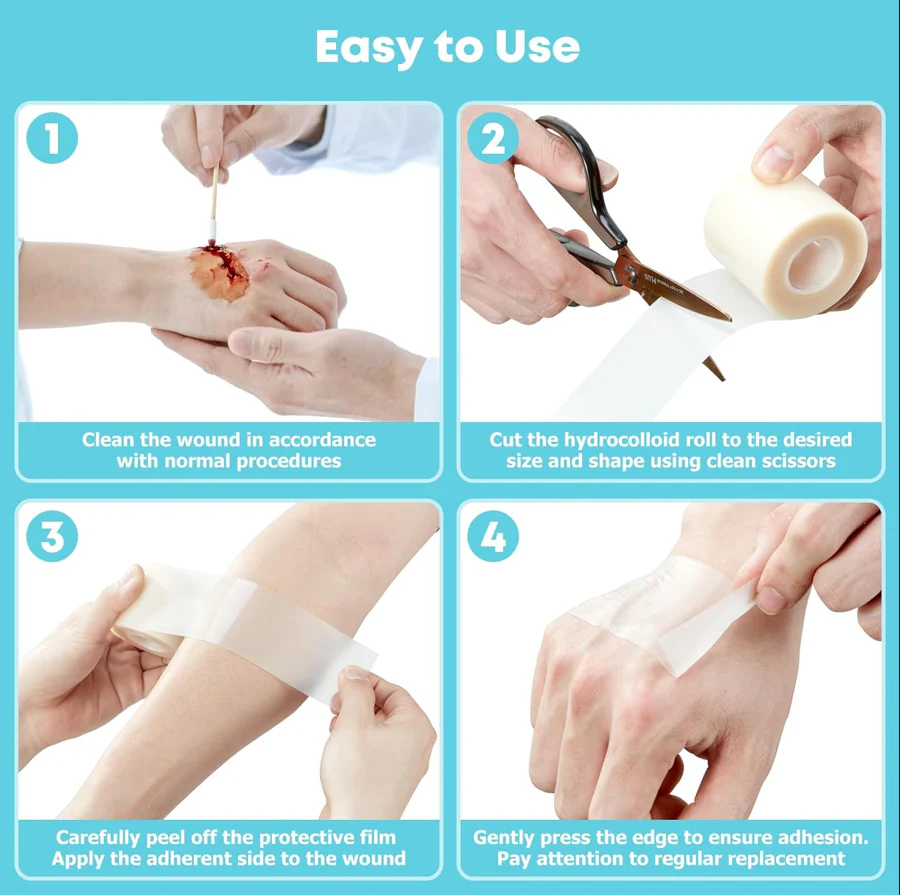 Hydrocolloid Roll for Wound Care