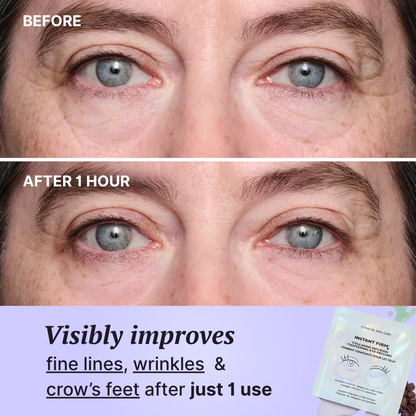 Instant Tightening Collagen Infusion Eye Patches